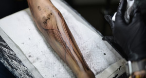 ¿Cuánto cuesta eliminar un tatuaje en España? Precios en 2025