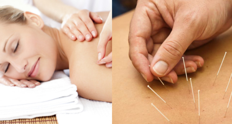 beneficios de la acupuntura