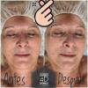 Tratamiento facial luminosidad y mejora de aspecto de la piel 