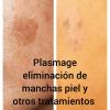 Plasmageeliminar manchas