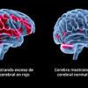 Terapia EMDR