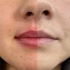 Micropigmentación de labios 