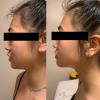 Tratamiento estética facial para desinflamación facial