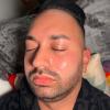 Limpieza Facial