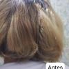 1) Antes