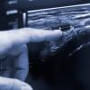 Fisionervión Fisioterapia En Barakaldo
