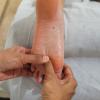 Podal reflexology