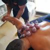 Ventosas cupping therapy