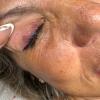 Correcion eye liner