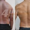 Reducción notable de grasa en la zona lumbar y mayor definición muscular en la espalda.