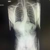 Mi radiografia