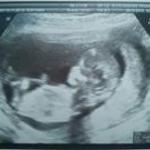 Fran Martínez Seoane Fran Martínez Seoane